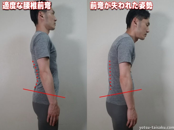 適度な腰椎前弯と腰痛の原因となる前弯が失われた姿勢